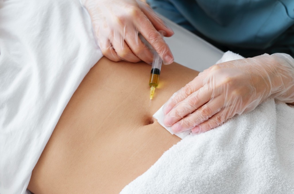 Meso-Fat treatment at Weshape Clinic